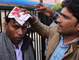 injured in protest