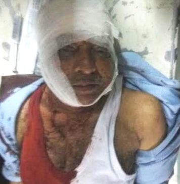 चौक थाने के पास सराफा के यहां करोड़ों की डकैती, विरोध पर पिता-पुत्र को किया घायल डकैती