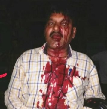 पुलिस पर हमला