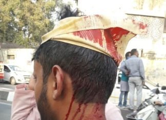 आप कार्यकर्ताओं पर लाठीचार्ज