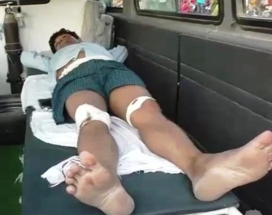 प्रोफेसर की पिटाई, जिंदा जलाने की