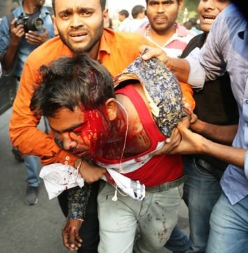रालोद ने कहा, योगी सरकार के पास लाठी-गोली के अलावा कुछ नहीं, शिक्षामित्रों को लेकर भी कही ये बात लाठी-गोली
