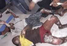 बच्‍चे झुलसे