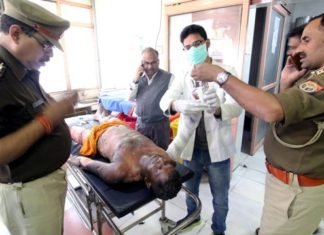 जमीन विवाद पर युवक ने बापू भवन के बाहर खुद को लगाई आग, हालत गंभीर, पुलिस ने घायल के साथी को इस वजह से किया गिरफ्तार बापू भवन