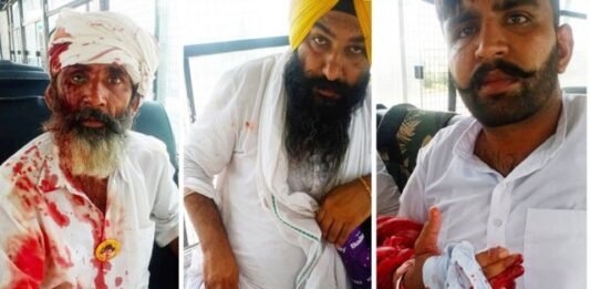 करनाल में पुलिस ने किसानों पर की लाठीचार्ज, कई घायल किसानों पर की लाठीचार्ज