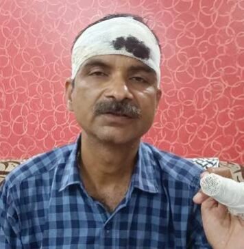 LDA के भ्रष्टाचार की उपाध्यक्ष के सामने सच्चाई लाने वाले सृष्टि अपार्टमेंट के विवेक शर्मा पर हुआ जानलेवा हमला, इंजीनियरों पर भी लगे आरोप विवेक शर्मा