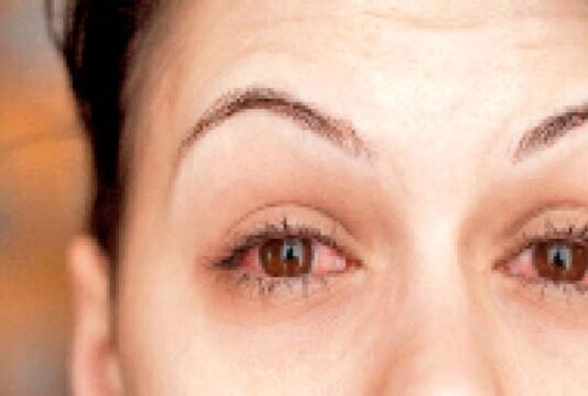 संक्रामक बीमारी