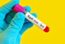 निपाह वायरस