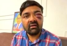 किसान नेताओं की बर्बर पिटाई पर विपक्ष ने योगी सरकार को घेरा, की अफसरों पर कार्रवाई की मांग किसान की पिटाई