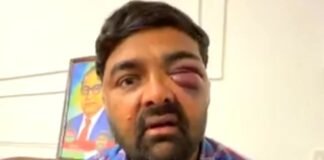 किसान नेताओं की बर्बर पिटाई पर विपक्ष ने योगी सरकार को घेरा, की अफसरों पर कार्रवाई की मांग किसान की पिटाई