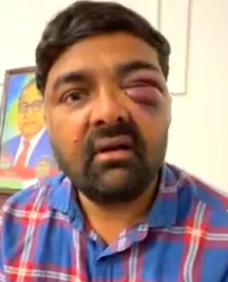 मेरठ में किसान नेताओं की पिटाई पर विपक्ष ने योगी सरकार को घेरा, की अफसरों पर कार्रवाई की मांग किसान की पिटाई